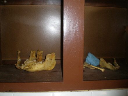 Jaw bones